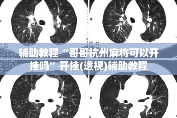 辅助教程“哥哥杭州麻将可以开挂吗	”开挂(透视)辅助教程