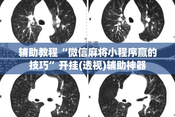 辅助教程“微信麻将小程序赢的技巧”开挂(透视)辅助神器