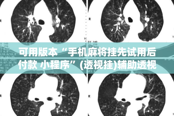 可用版本“手机麻将挂先试用后付款 小程序”(透视挂)辅助透视教程