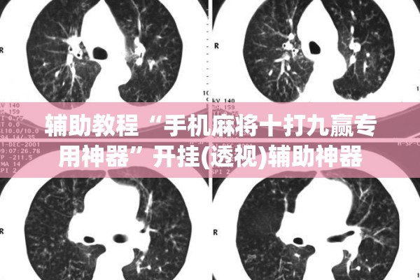 辅助教程“手机麻将十打九赢专用神器”开挂(透视)辅助神器