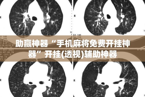 助赢神器“手机麻将免费开挂神器”开挂(透视)辅助神器